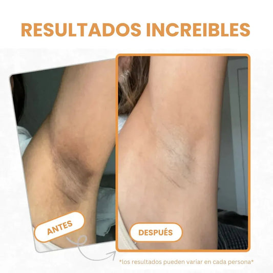 Lumea® | Loción Corporal Aclarante