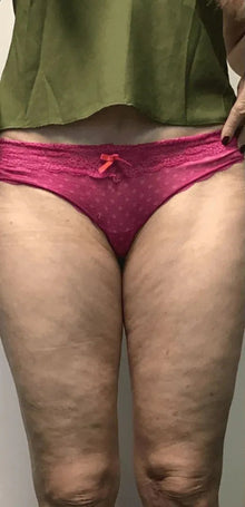 Before - “No esperaba mucho, pero me sorprendió.”