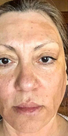 Before - Ok, pero esta mascarilla???