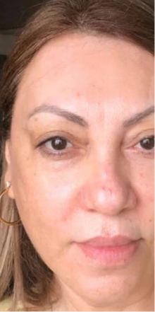 After - Ok, pero esta mascarilla???